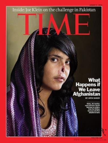 在塔利班授意下,才18歲的阿富汗少婦艾殺慘遭丈夫割除鼻子和雙耳