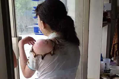 合肥女生被潑酒精燒傷 合肥男生太殘忍燒女生