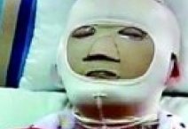 都是周巖 陶汝坤 早戀惹的禍 周巖被陶汝坤毀容女方