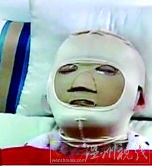 毀容事件女方否認索賠千萬 稱肇事方網絡造謠