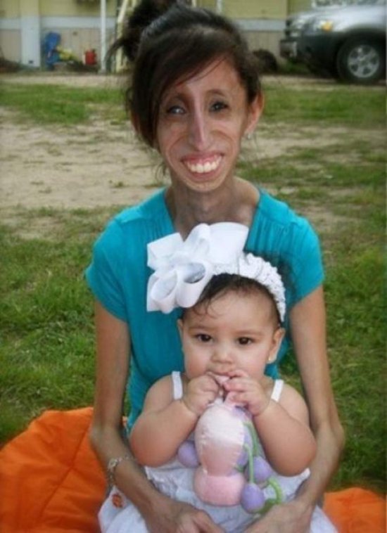 美國零脂肪女孩