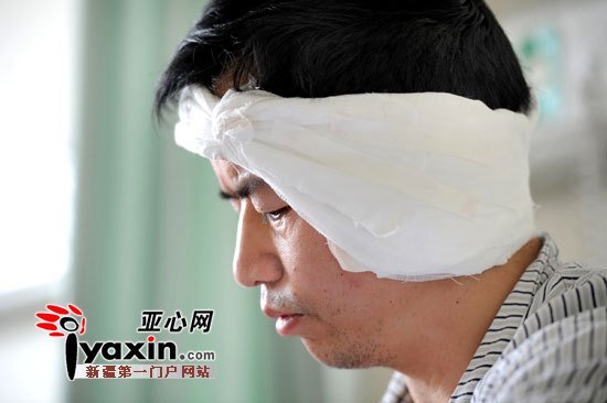 研究生咬掉廚師左耳