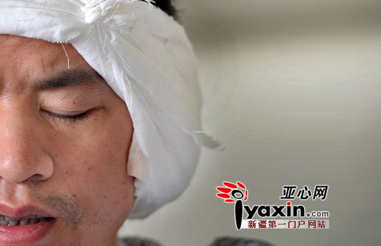 研究生咬掉廚師左耳