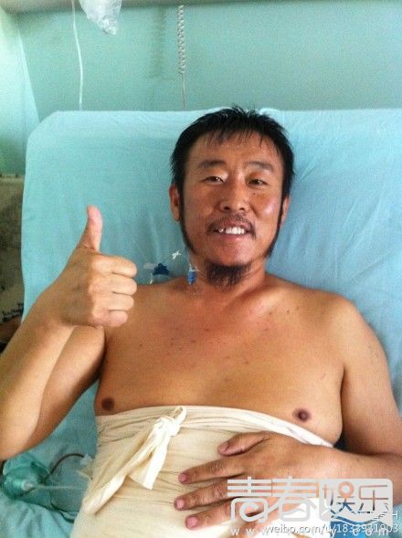 演員高昌昊拍戲受傷住院治療