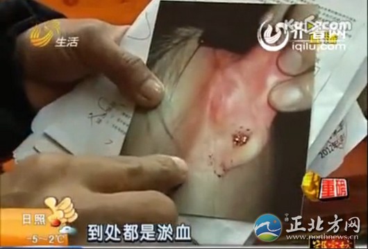 16歲女生遭室友毆打