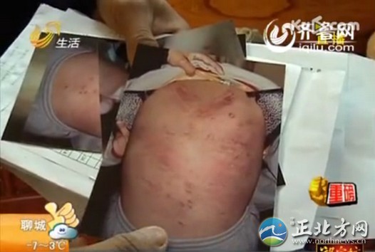 16歲女生遭室友毆打