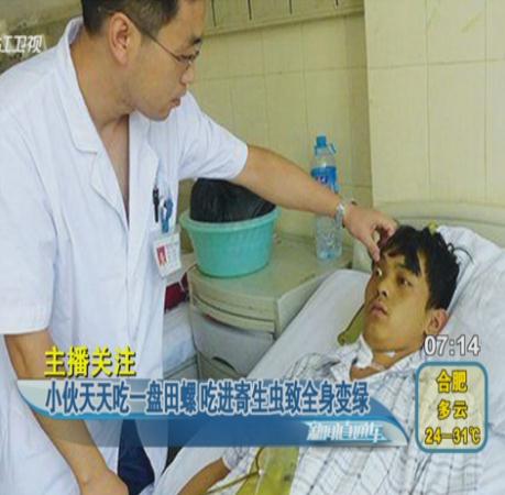 吃田螺全身變綠 吃了幾個月炒田螺吃進(jìn)寄生蟲