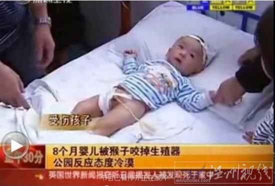 男嬰睪丸被猴子吞食