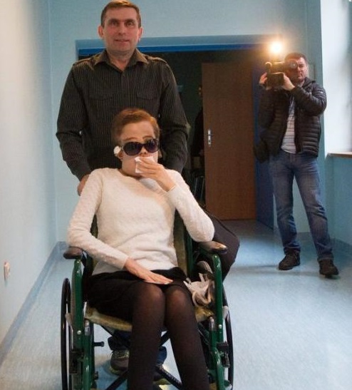 波蘭換臉手術成功案例 26歲女子成功換臉