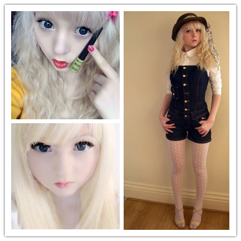 英國(guó)白化病女孩