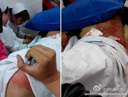 學(xué)生放學(xué)路上被砍1死2傷 安康學(xué)生放學(xué)路上被陌生人刀砍