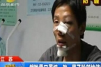 南京小伙子被口罩傷臉 防霾口罩成傷臉暗器口罩毀容