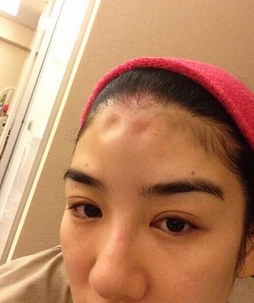 黃奕曬遭家暴照片 指責丈夫在自己懷孕期間出軌