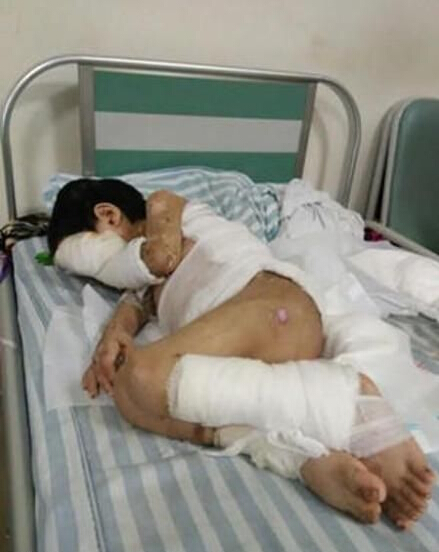 江蘇7歲男孩遭精神病父母虐待