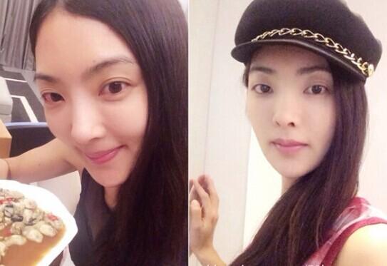 吳速玲整容前后照片