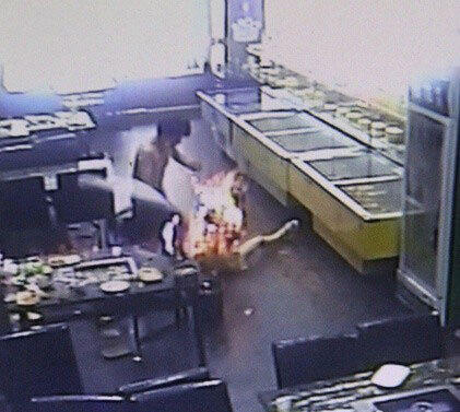 女大學(xué)生吃燒烤被燒