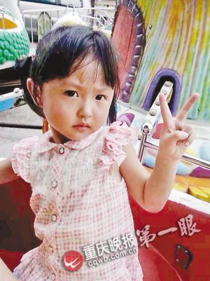 女孩跌進熱油桶被燙傷