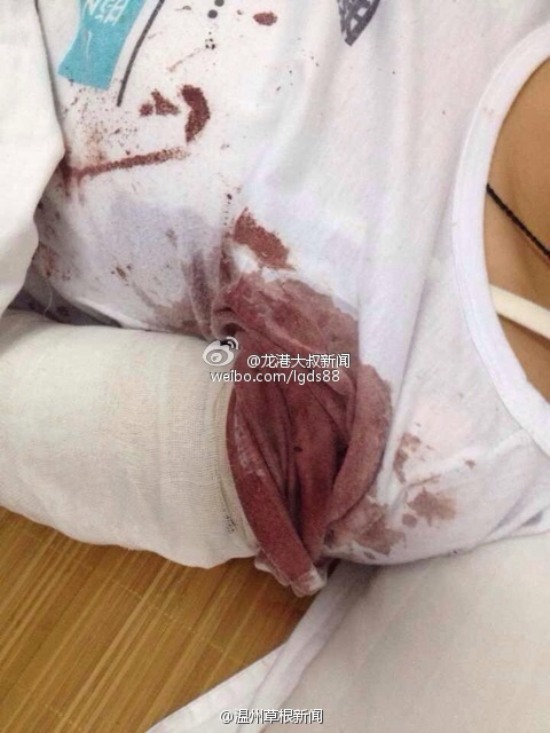 蒼南龍港第九中學女生用剪刀捅傷同學