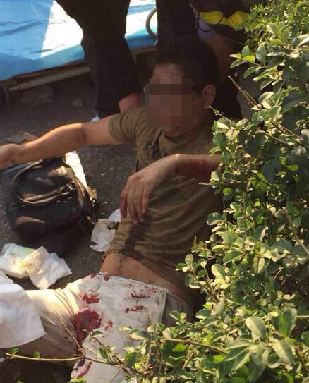 女子穿高跟鞋開車把路邊男子腳掌撞斷