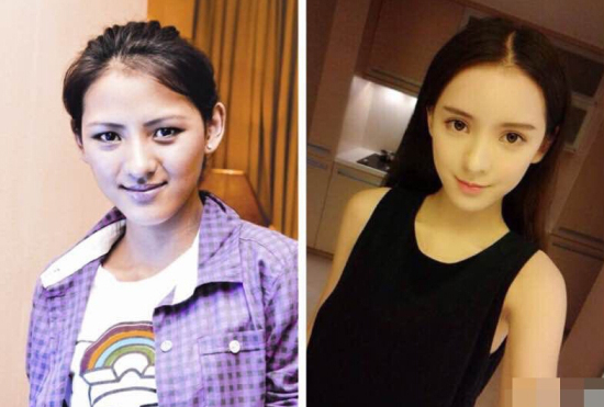 張予曦整容前后照片對比