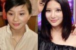 熊乃瑾整容前后照片對比 熊乃瑾自己也承認整容