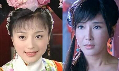 秦嵐整容前后對比照片