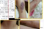 金賢重家暴女友是真的嗎 金賢重女友受虐照片