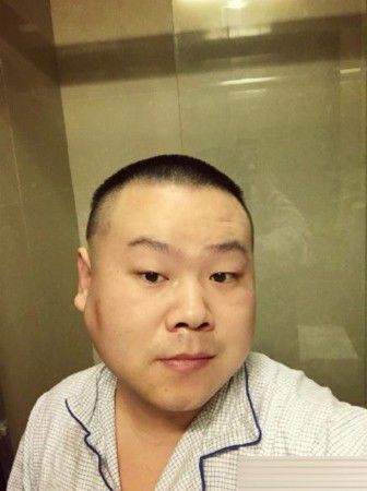 岳云鵬腫瘤手術成功