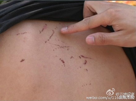 鄭州女老師圍毆男生