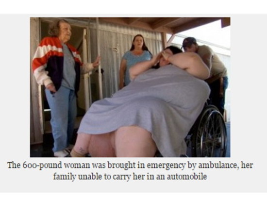 體重272公斤的女子產(chǎn)下18公斤巨嬰