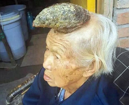 老太頭上長出獨角
