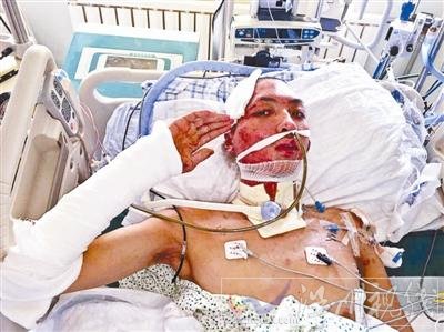 天津事故昏迷消防員蘇醒