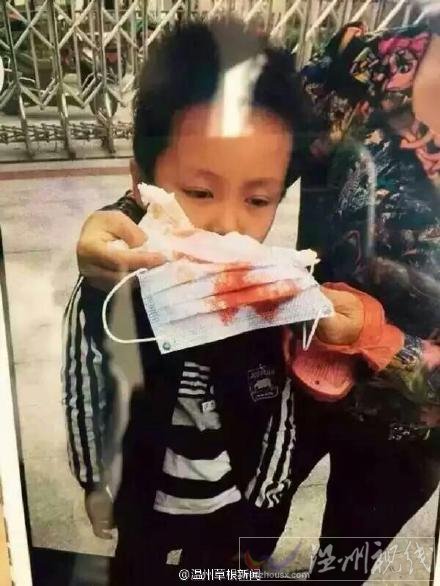 多名小學(xué)生出現(xiàn)流鼻血