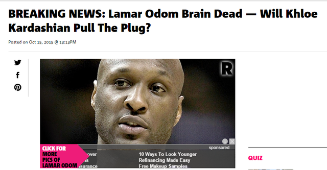 曝奧多姆已經腦死亡