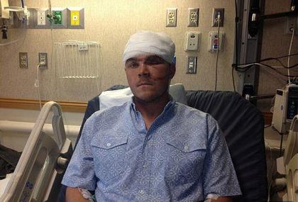 機智男手臂塞熊嘴 嚇倒對方逃過一劫