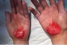 學(xué)生被罰用手走路