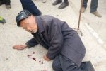 吐血乞討 宿州八旬老人吐血乞討