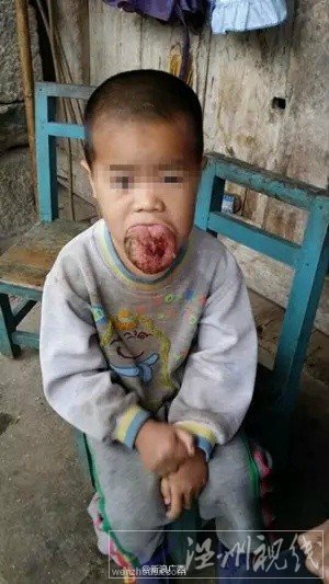 4歲巨舌男童小騰照片