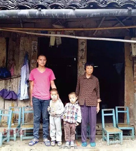 男童天生長巨舌