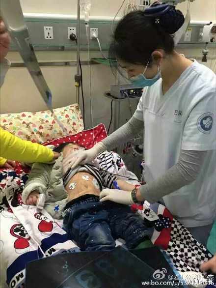 女童被繼母打昏迷