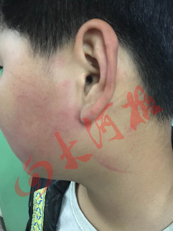 男童撞校長(zhǎng)遭暴打