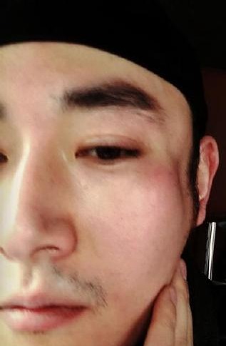 果郡王拍戲毀容