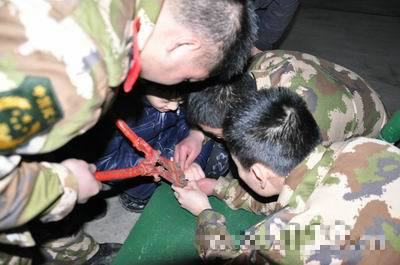 男童手指卡鐵環