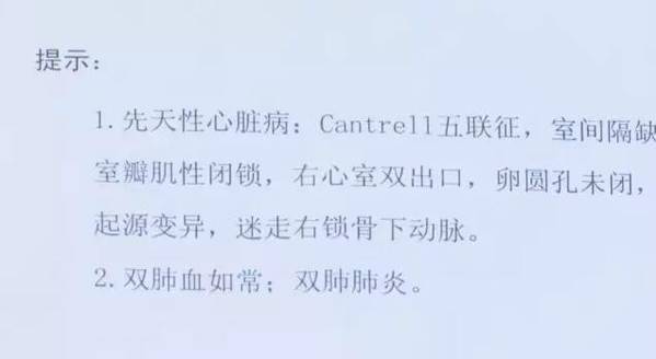 寶寶心臟長外面