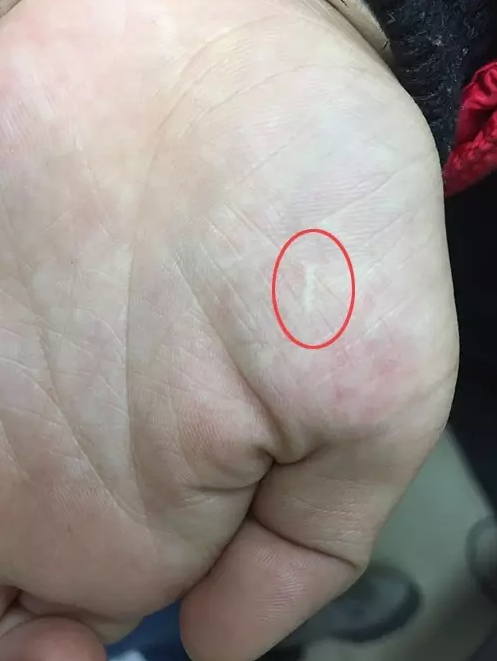 江湖游醫(yī)割手治眼