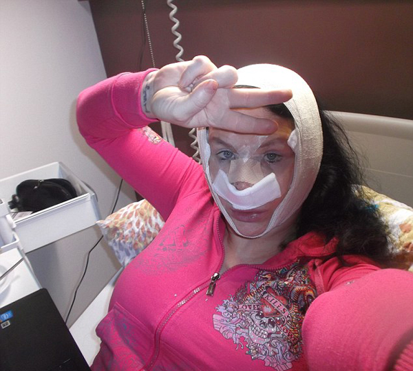 女子18年整容36次