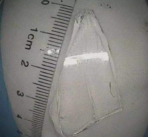 女孩吞下大塊玻璃