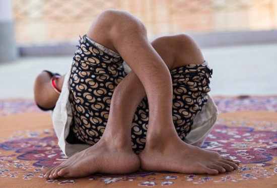 女孩骨頭碎1000次