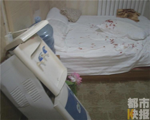 酒店枕頭驚現刺猬