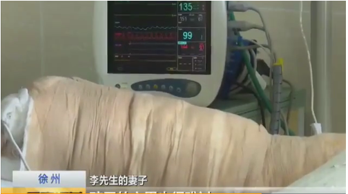 點蚊香引燃父親